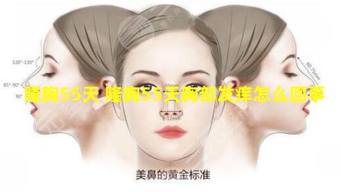 隆胸55天 隆胸55天胸部发痒怎么回事